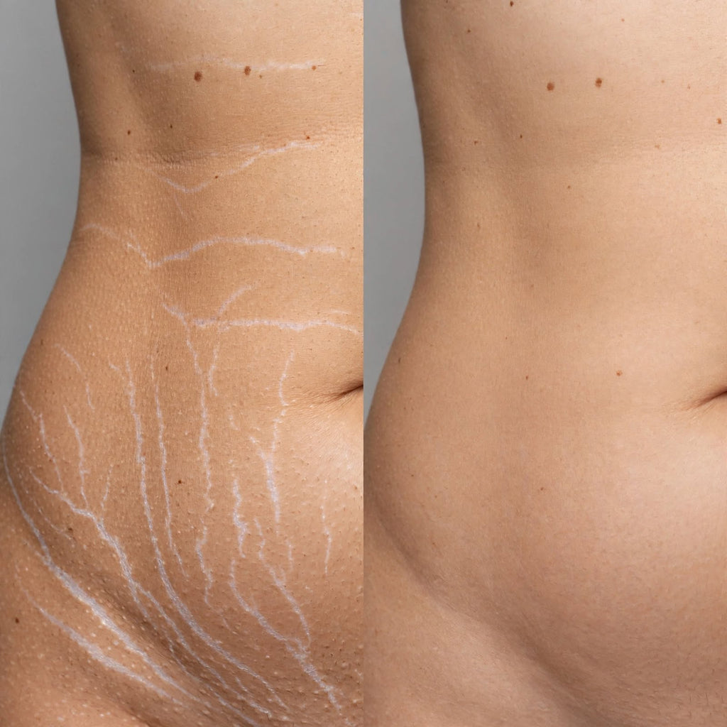 ADVEX Stretch Mark Camouflage PRO - $697