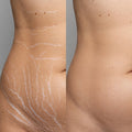 ADVEX Stretch Mark Camouflage PRO - $697